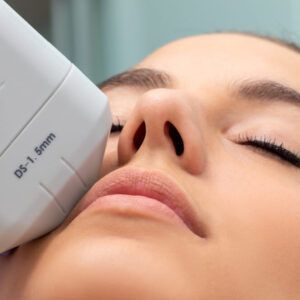 HIFU FACIAL